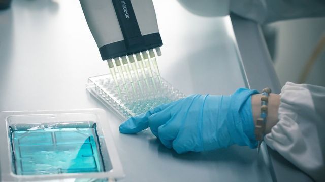 An Introduction to the Enzyme-Linked Immunosorbent Assay – ELISA Test content piece image 