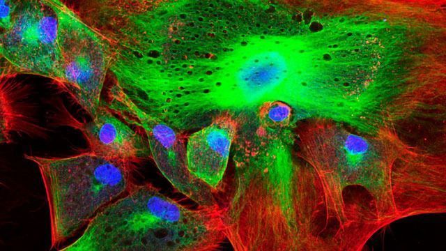 Caring for Your Confocal Microscope content piece image 
