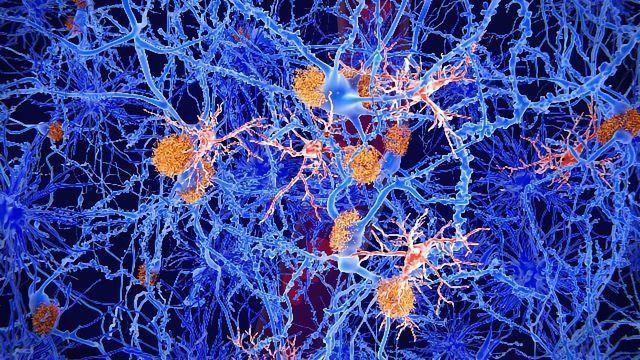 Fighting Neurodegeneration by Understanding Inflammation content piece image 