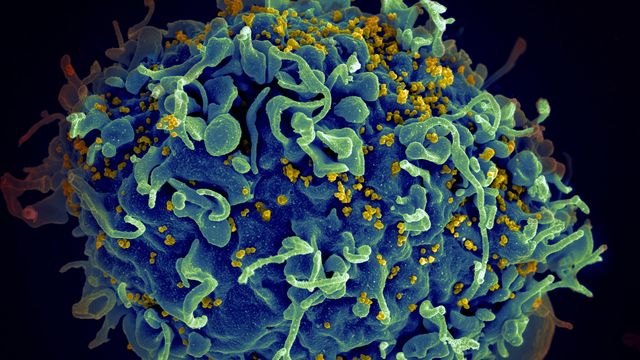 HIV attacking a cell. 