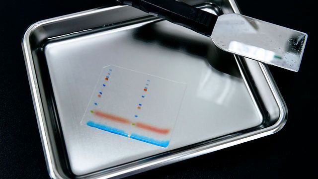 How To Ensure a Successful Western Blot Experiment content piece image 