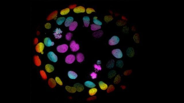 Plant-Based Gel Designed To Fast-Track Organoid Growth content piece image 