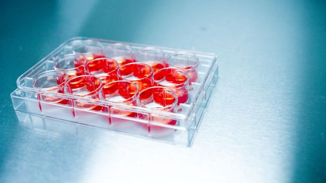 A 12 well plate containing red media. 