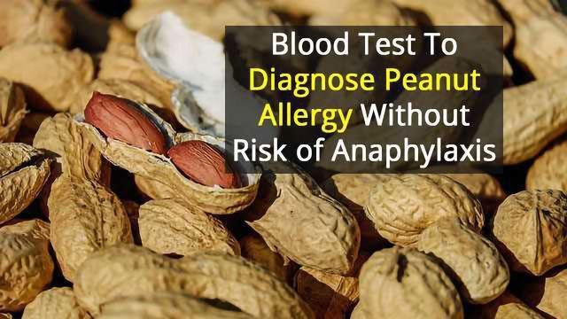 Test to Safely and Accurately Diagnose Peanut Allergies content piece image 