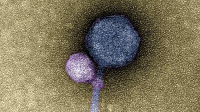 A TEM image of a satellite virus latching on to its helper virus.  